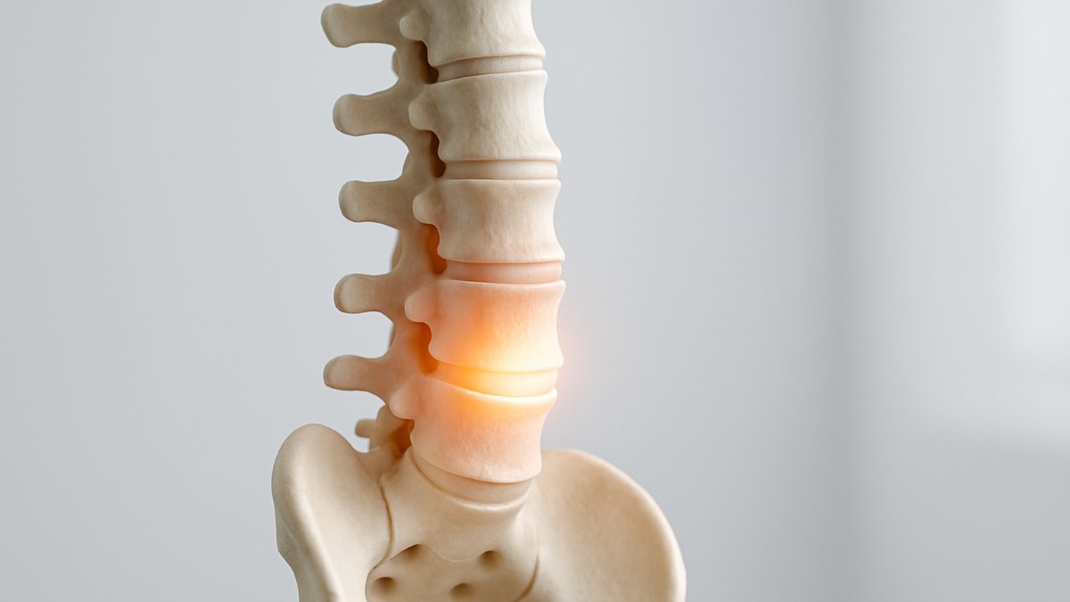 The Effects of an 8-Week Dynamic Neuromuscular Stabilization Exercise on Pain, Functional Disability, and Quality of Life in Individuals With Non-Specific Chronic Low Back Pain: A Randomized Clinical Trial With a Two-Month Follow-Up Study