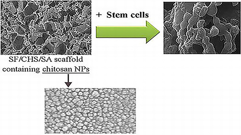 Incorporation of Chitosan Nanoparticles Into Silk Fibroin-Based Porous Scaffolds: Chondrogenic Differentiation of Stem Cells