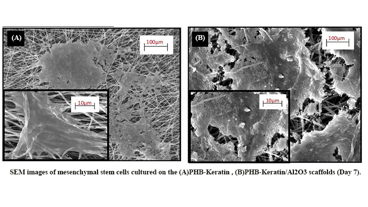 Biological Evaluation and Osteogenic Potential of Polyhydroxybutyrate-Keratin/Al2o3 Electrospun Nanocomposite Scaffold: A Novel Bone Regeneration Construct