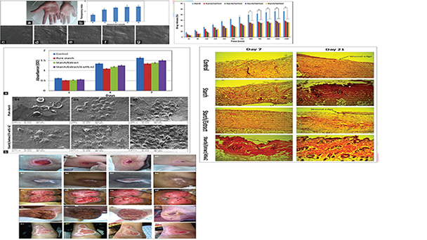 Effects of Nanozeolite/Starch Thermoplastic Hydrogels on Wound Healing
