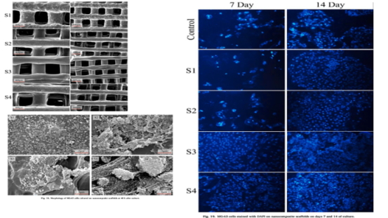 Synergetic Effect of Bioglass and Nano Montmorillonite on 3D Printed Nanocomposite of Polycaprolactone/Gelatin in the Fabrication of Bone Scaffolds