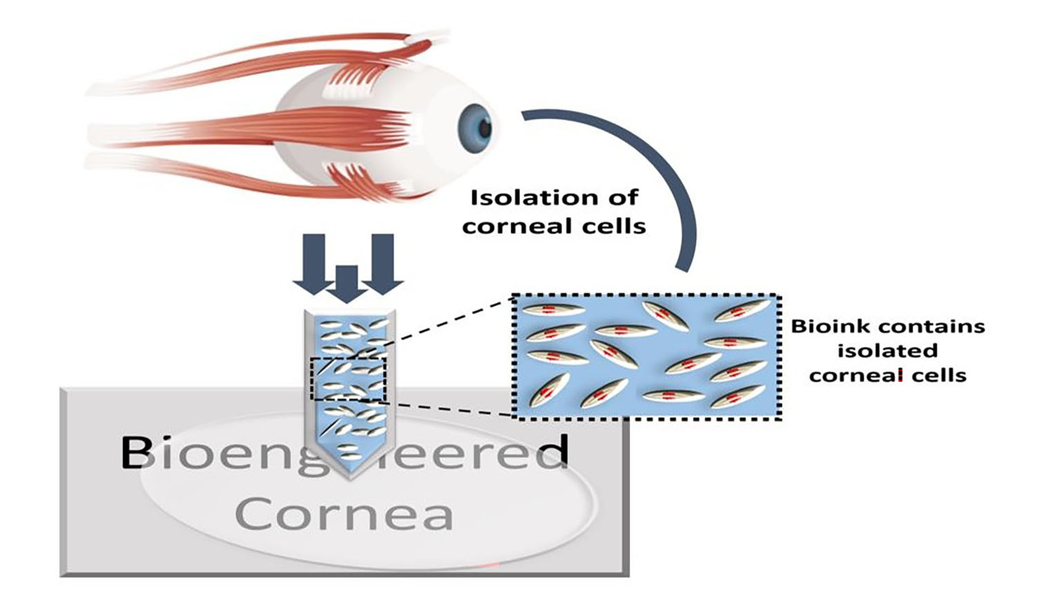 Bioprinted Membranes for Corneal Tissue Engineering: A Review