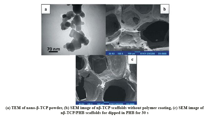 Evaluation of Physical, Mechanical and Biological Properties of Β-Tri-Calcium Phosphate/Poly-3-Hydroxybutyrate Nano Composite Scaffold for Bone Tissue Engineering Application