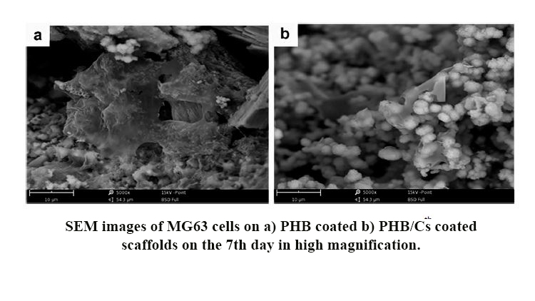 Evaluation of Physical, Mechanical and Biological Properties of Bioglass/Titania Scaffold Coated With Poly (3-Hydroxybutyrate)-Chitosan for Bone Tissue Engineering Applications