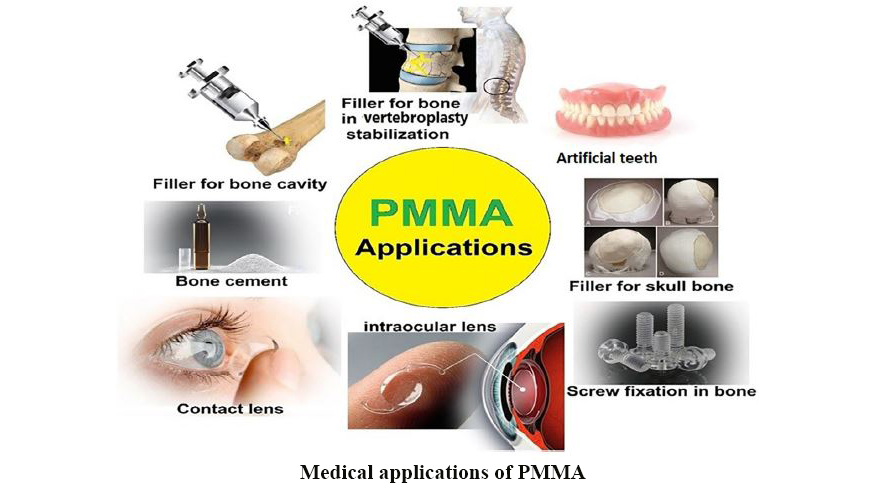 Poly(Methyl Methacrylate) Bone Cement, Its Rise, Growth, Downfall and Future