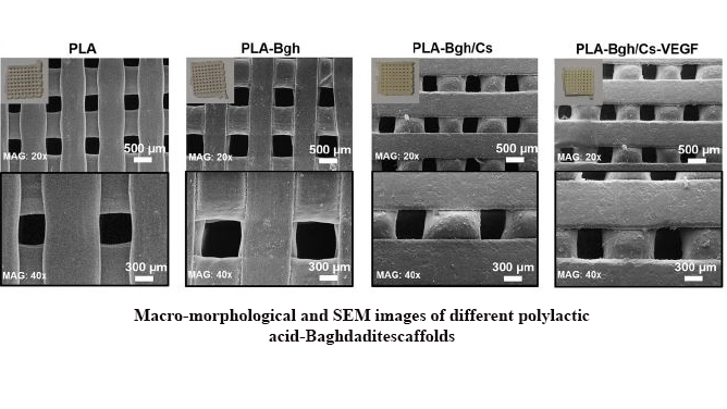 A 3D Printed Polylactic Acid-Baghdadite Nanocomposite Scaffold Coated With Microporous Chitosan-Vegf for Bone Regeneration Applications