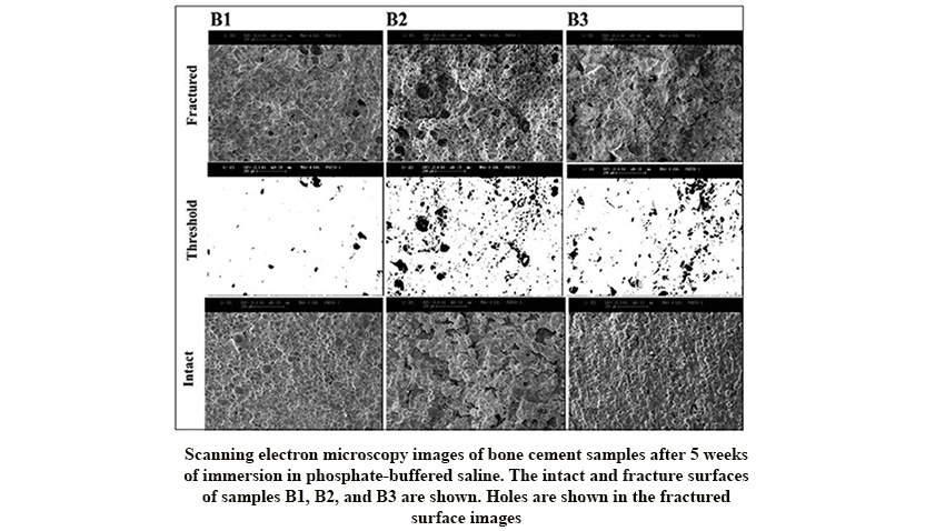 Rifampin-Loaded Mesoporous Silica Nanoparticles Improved Physical and Mechanical Properties and Biological Response of Acrylic Bone Cement