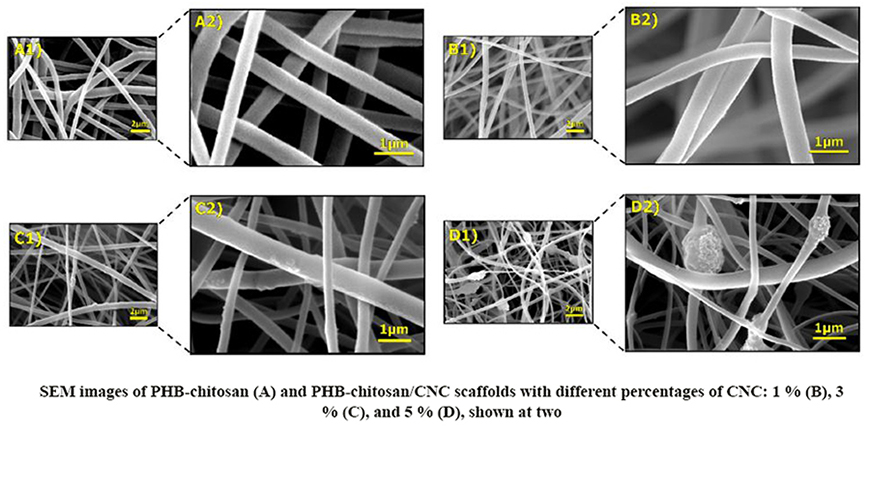 Evaluation of Phb-Chitosan/Cnc Scaffolds' Applicability for Bone Tissue Engineering Via Mg-63 Osteoblastic Cell Cultivation and Osteogenic Markers Gene Expression