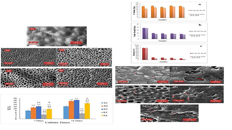 Preparation and in Vitro Evaluation of Polycaprolactone/Peg/Bioactive Glass Nanopowders Nanocomposite Membranes for Gtr/Gbr Applications