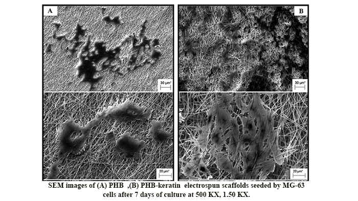 Evaluation of the Effects of Keratin on Physical, Mechanical and Biological Properties of Poly (3-Hydroxybutyrate) Electrospun Scaffold: Potential Application in Bone Tissue Engineering