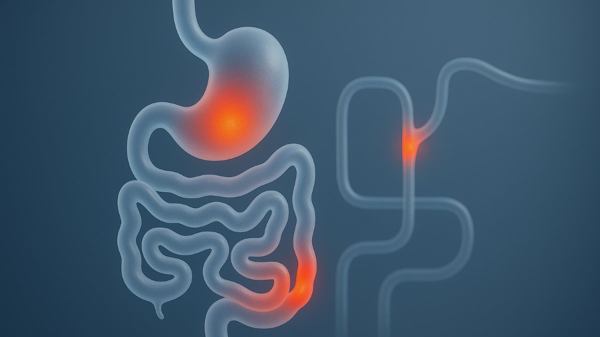 Consumption of Dietary Fiber in Relation to Psychological Disorders in Adults