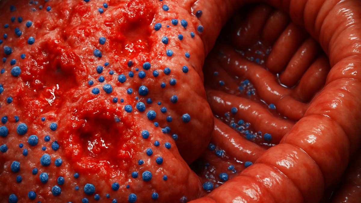 Molecular Epidemiology of Clostridium Difficile Infection in Iranian Hospitals