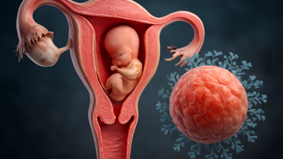 The Prospective Epidemiological Research Studies in Iran (Persian) Birth Cohort Protocol: Rationale, Design and Methodology