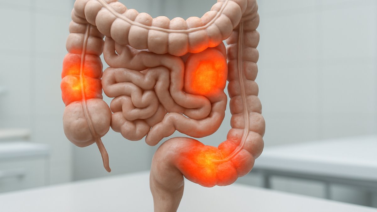 The Effect of Probiotics on Oxidized Ldl Levels: A Systematic Review and Meta-Analysis of Clinical Trials